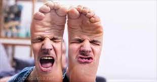 Stink foot